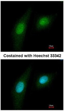 PIM2 Antibody, Novus Biologicals 0.1mg; Unlabeled:Antibodies, Polyclonal