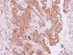 PIM2 Antibody, Novus Biologicals 0.1mg; Unlabeled:Antibodies, Polyclonal
