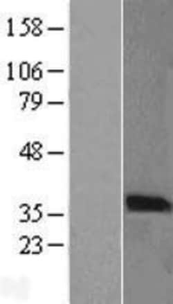 Novus Biologicals&trade;&nbsp;PIM2 Overexpression Lysate