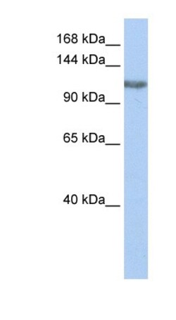 PIMT Antibody, Novus Biologicals 100&mu;L; Unlabeled:Antibodies, Polyclonal
