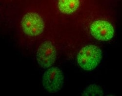 Pin1 Antibody, Novus Biologicals 0.1 mL; Unconjugated:Antibodies, Polyclonal