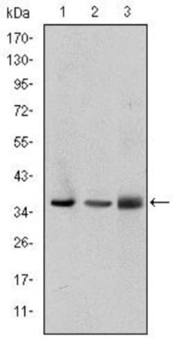 PINCH1/LIMS1 Antibody (5G7), Novus Biologicals:Antibodies:Primary Antibodies