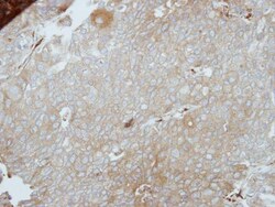 PINCH1/LIMS1 Antibody, Novus Biologicals 0.1mL; Unlabeled:Antibodies, Polyclonal
