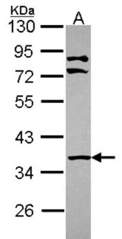 PINCH1/LIMS1 Antibody, Novus Biologicals 0.1mL; Unlabeled:Antibodies, Polyclonal