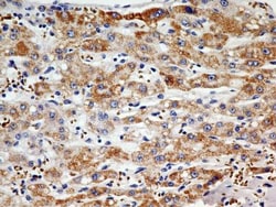 PINK1 Antibody (8E10.1D6) - BSA Free, Novus Biologicals 0.1mg; Unlabeled:Antibodies,