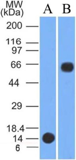 PINK1 Antibody (8E10.1D6) - BSA Free, Novus Biologicals 0.1mg; Unlabeled:Antibodies,