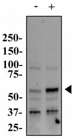 PINK1 Antibody (8E10.1D6) - BSA Free, Novus Biologicals 0.1mg; Unlabeled:Antibodies,