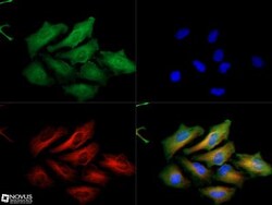 PINK1 Antibody - BSA Free, Novus Biologicals 0.025mL; Unlabeled:Antibodies,