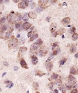 PINK1 Antibody - BSA Free, Novus Biologicals 0.025mL; Unlabeled:Antibodies,