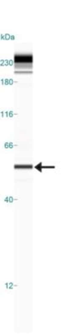 PINK1 Antibody - BSA Free, Novus Biologicals 0.1mg; Unlabeled:Antibodies,