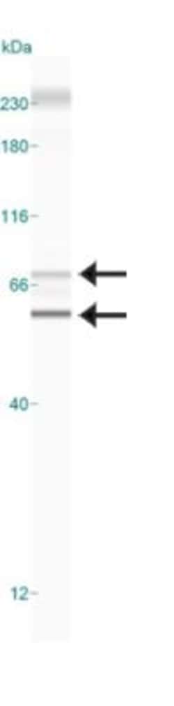 PINK1 Antibody - BSA Free, Novus Biologicals 0.025mL; Unlabeled:Antibodies,