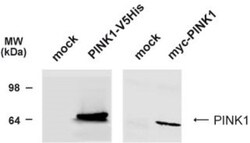 PINK1 Antibody - BSA Free, Novus Biologicals 0.1mg; Unlabeled:Antibodies,