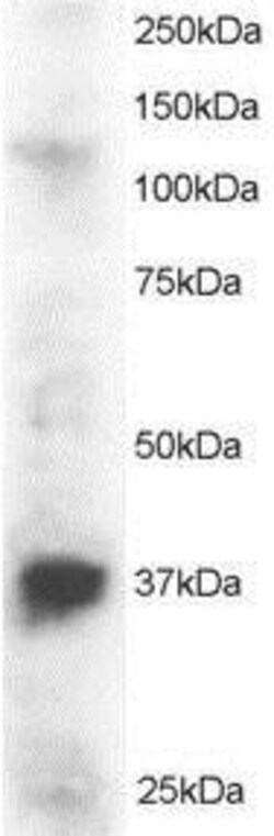 PINX1 Antibody, Novus Biologicals 0.1mg; Unlabeled:Antibodies, Polyclonal