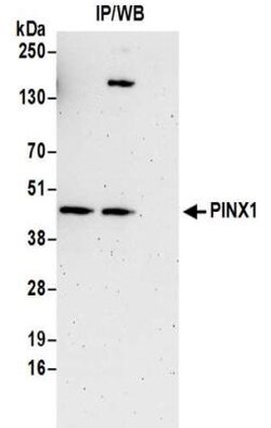 PINX1 Antibody, Novus Biologicals 0.1mg; Unlabeled:Antibodies, Polyclonal
