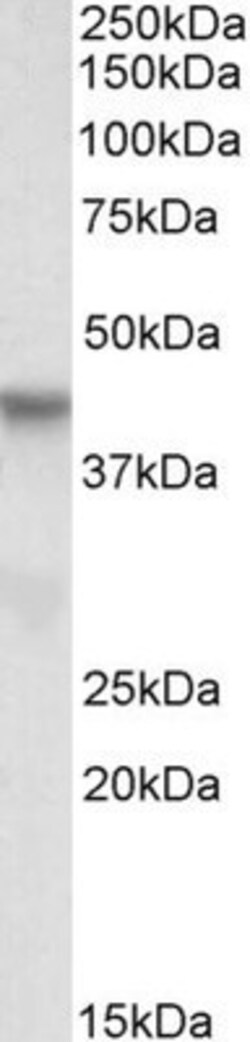 PINX1 Antibody, Novus Biologicals 0.1mg; Unlabeled:Antibodies, Polyclonal