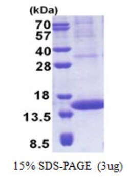 Novus Biologicals Recombinant Human PIP His Protein 0.1 mg | Buy Online | Novus Biologicals&trade; | Fisher Scientific