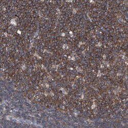 PIP5K1 alpha Antibody, Novus Biologicals 0.1mL; Unlabeled:Antibodies, Polyclonal