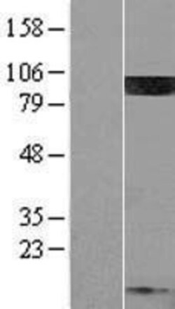 Novus Biologicals&trade;&nbsp;PIP5K1C Overexpression Lysate