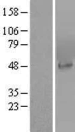 Novus Biologicals™ PIP5K2 alpha Overexpression Lysate