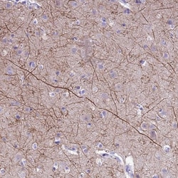 PIP5K2B Antibody, Novus Biologicals 0.1mL; Unlabeled:Antibodies, Polyclonal