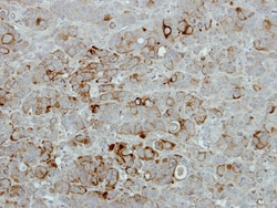 PIP5K2B Antibody, Novus Biologicals 0.1mL; Unlabeled:Antibodies, Polyclonal