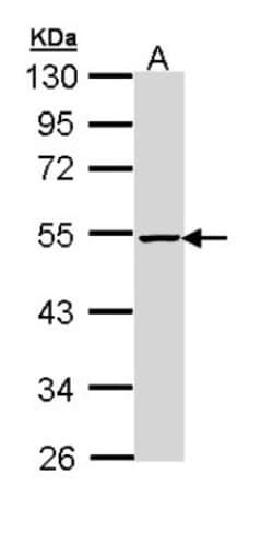 PIP5K2B Antibody, Novus Biologicals 0.1mL; Unlabeled:Antibodies, Polyclonal
