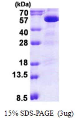 Novus Biologicals&trade;&nbsp;Recombinant Human PIP5K2B His Protein