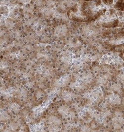 PIP5K2 gamma Antibody, Novus Biologicals 0.1mL; Unlabeled:Antibodies, Polyclonal