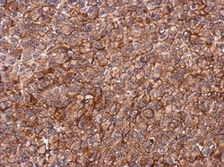 PIP5KL1 Antibody, Novus Biologicals 0.1mL; Unlabeled:Antibodies, Polyclonal