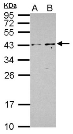 PIP5KL1 Antibody, Novus Biologicals 0.1mL; Unlabeled:Antibodies, Polyclonal
