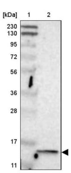PIP Antibody, Novus Biologicals 0.1mL; Unlabeled:Antibodies, Polyclonal