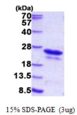 Novus Biologicals&trade;&nbsp;Recombinant Human PIPPIN His Protein