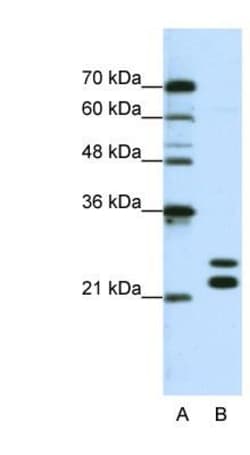 PIPPIN Antibody, Novus Biologicals:Antibodies:Primary Antibodies
