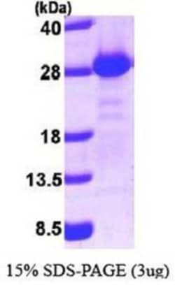 Novus Biologicals&trade;&nbsp;Recombinant Human PIST His Protein