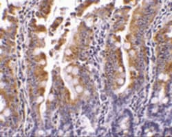 PIST Antibody - BSA Free, Novus Biologicals 0.025 mg, Unconjugated:Antibodies,