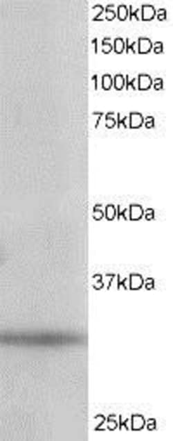 PITPN Antibody, Novus Biologicals 0.1mg; Unlabeled:Antibodies, Polyclonal