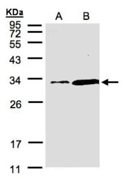 PITPN Antibody, Novus Biologicals 0.1mg; Unlabeled:Antibodies, Polyclonal