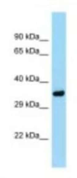 PITPN Antibody, Novus Biologicals 100&mu;L; Unlabeled:Antibodies, Polyclonal