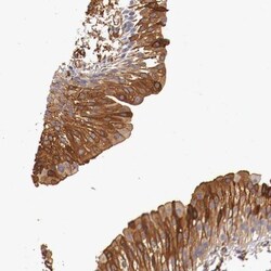 PITPNB Antibody, Novus Biologicals 25 &mu;L; Unlabeled:Antibodies, Polyclonal