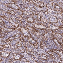PITPNM3 Antibody, Novus Biologicals 25 &mu;L, Unlabeled:Antibodies, Polyclonal