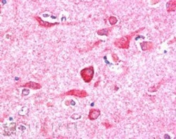 PITPNM3 Antibody, Novus Biologicals 0.1mg; Unlabeled:Antibodies, Polyclonal
