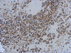 PITRM1 Antibody, Novus Biologicals 0.1 mL | Buy Online | Novus Biologicals | Fisher Scientific