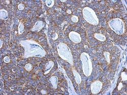 PITRM1 Antibody, Novus Biologicals 0.1mL; Unlabeled:Antibodies, Polyclonal