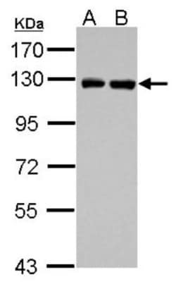 PITRM1 Antibody, Novus Biologicals 0.1mL; Unlabeled:Antibodies, Polyclonal