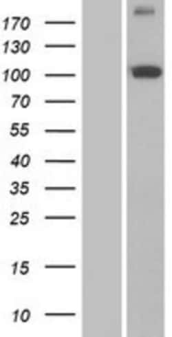 Novus Biologicals&trade;&nbsp;PITRM1 Overexpression Lysate