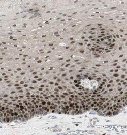 PITX1 Antibody, Novus Biologicals 0.1mL; Unlabeled:Antibodies, Polyclonal