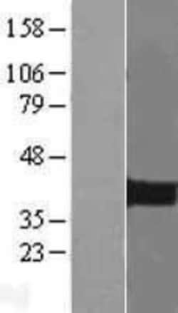 Novus Biologicals&trade;&nbsp;PITX2 Overexpression Lysate