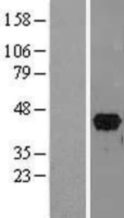 Novus Biologicals&trade;&nbsp;PITX2 Overexpression Lysate