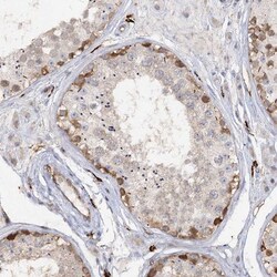 PIWIL4 Antibody, Novus Biologicals 25 &mu;L | Buy Online | Novus Biologicals | Fisher Scientific
