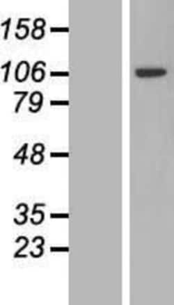 Novus Biologicals&trade;&nbsp;PJA2/Praja2 Overexpression Lysate